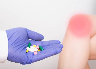 Doktor, kızların bacak ve dizlerinin arkasında bir avuç dolusu hap tutuyor. Diz hastalıkları, eklem iltihabı, kondromatör ve iltihap önleyici ilaçların tedavisi kavramı