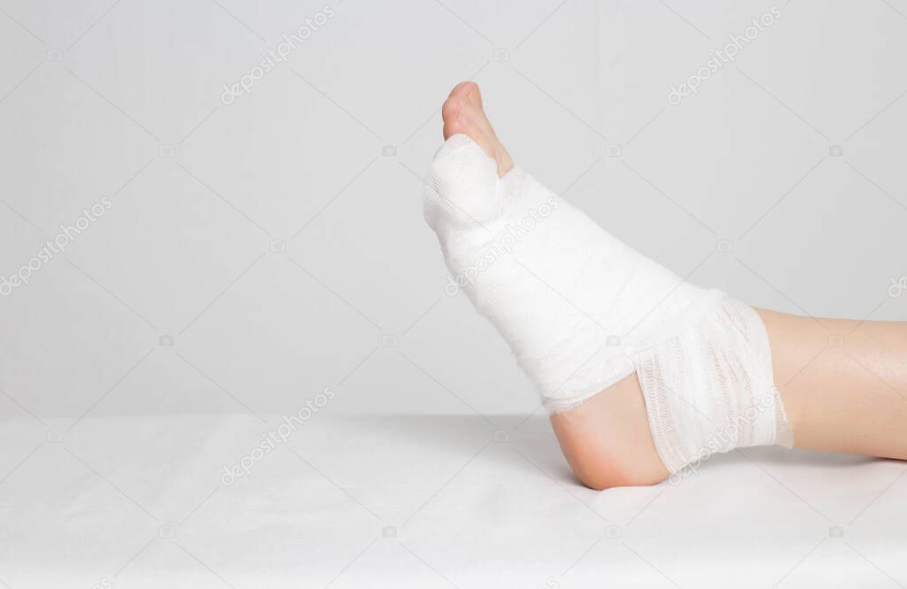 Mans bandaged foot with little finger on a white background. The concept of a fracture of the little finger on the leg with offset, copy space, deformation