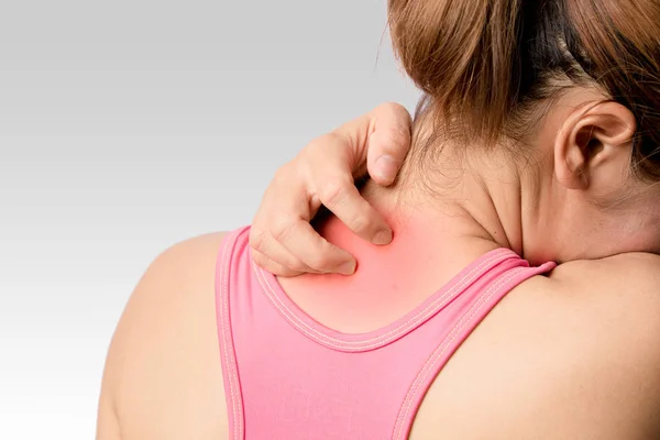 Young Woman Scratching Upper Back Neck Rash White Background — Stock Photo, Image