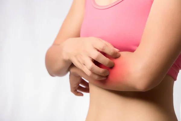 Mujer Joven Sosteniendo Mano Derecha Arañando Erupción Brazo Izquierdo Sobre — Foto de Stock