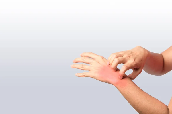 right hand scratching left wrist joint, rash at left wrist joint of woman