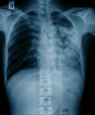 koleksiyon x-ray görüntü 
