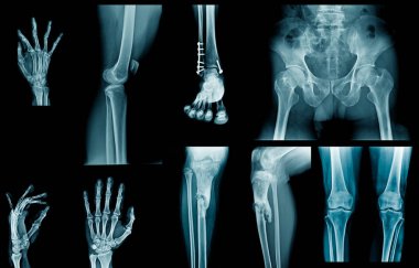 koleksiyon x-ray mavi ses tonuyla 