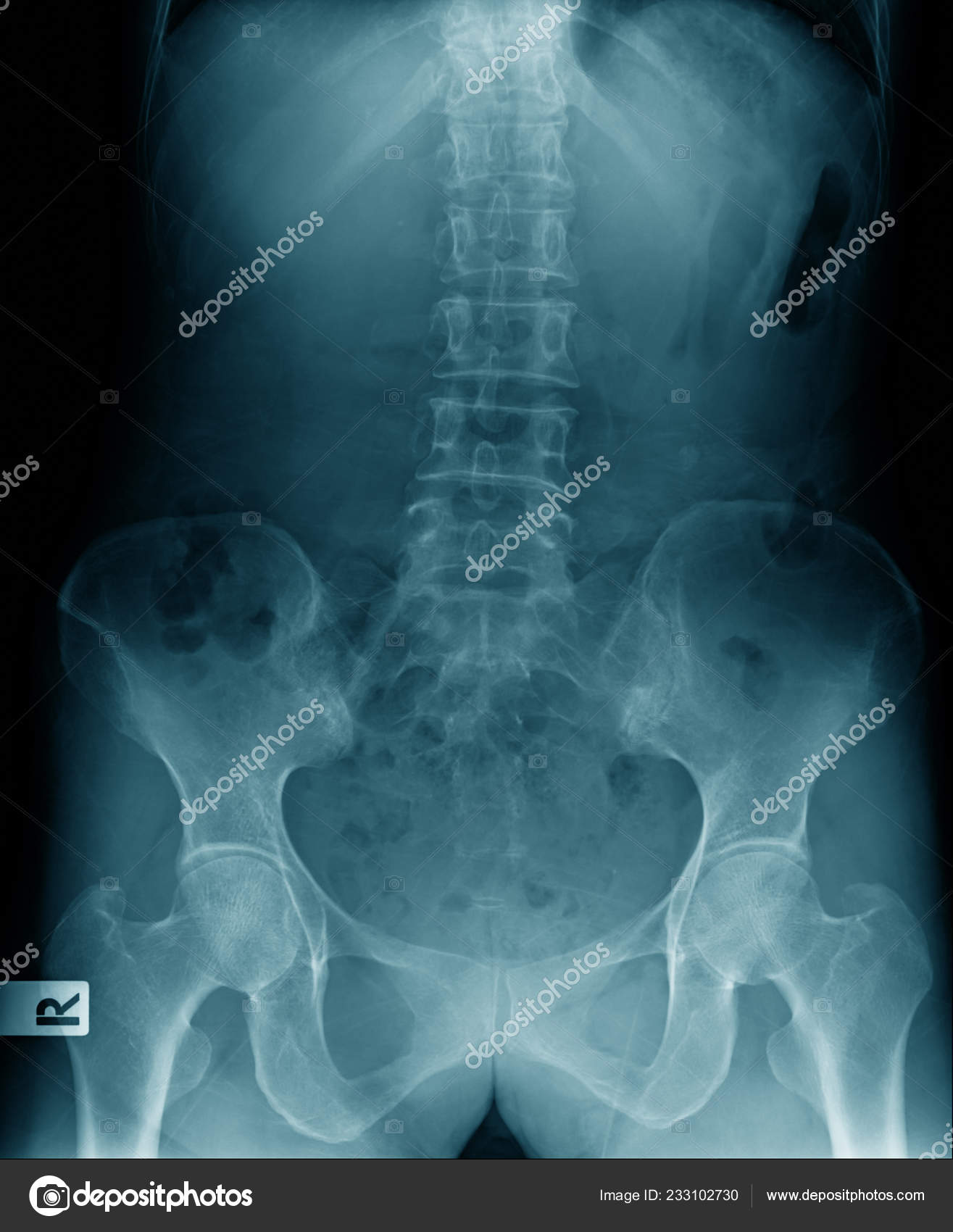 100+] Imagens Do Homem-aranha | Wallpapers.com, image size:1315x1700