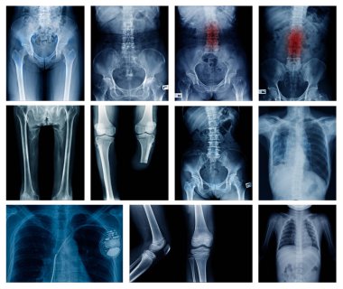 Yüksek kaliteli koleksiyonu x-ray görüntü göstermek insan birçok gövde bölümü