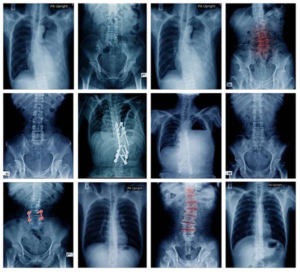 big collection back and pelvic x-ray, high quality setof x-ray