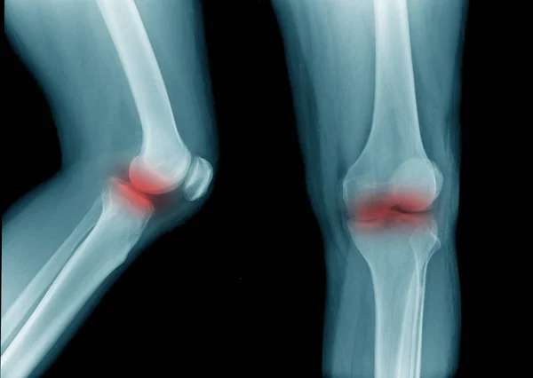 x-ray image knee joint with banner design for webpage and hight quality print