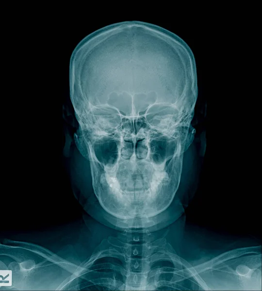 Radiografia del cranio e parte della colonna vertebrale cervicale — Foto Stock