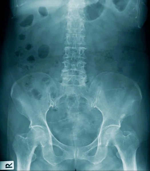 X-ray image of human spine — Stock Photo, Image