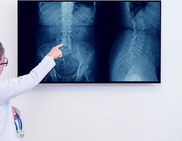 Mujer médico señalando el dedo índice a la columna vertebral imagen de rayos X — Foto de Stock