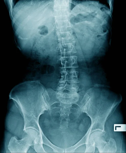 蓝调人类脊柱的X射线图像 — 图库照片