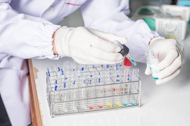 Tıbbi laboratuvarda bir tepsiye düzenlenmiş test tüplerinin yakın çekim.