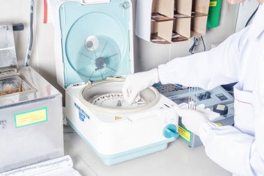 Tıbbi laboratuvarda bir tepsiye düzenlenmiş test tüplerinin yakın çekim.