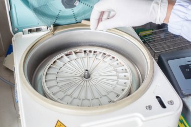 Tıbbi laboratuvarda bir tepsiye düzenlenmiş test tüplerinin yakın çekim.