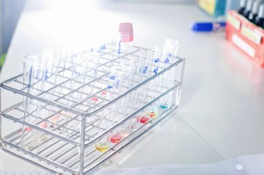 Tıbbi laboratuvarda bir tepsiye düzenlenmiş test tüplerinin yakın çekim.