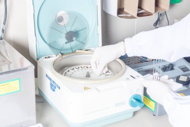 Tıbbi laboratuvarda bir tepsiye düzenlenmiş test tüplerinin yakın çekim.