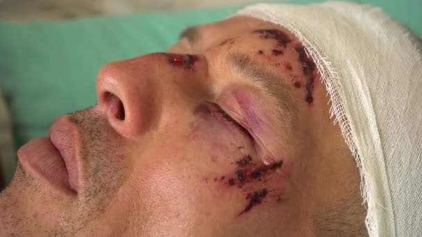 Muž Skutečnými Ranami Otlaky Krví Obličeji Nehodě Nemocniční Ošetření — Stock video