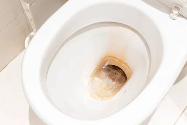 Špinavá Nehygienická Toaletní Mísa Vápencovou Skvrnou Veřejných Záchodech Zblízka — Stock fotografie