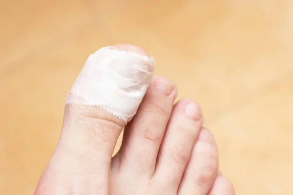 Kvinnas Nakna Foten Med Ett Bandage Sårade Förstahjälpen — Stockfoto