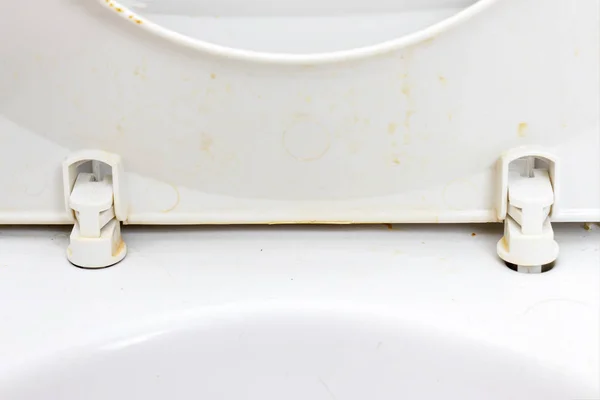 Vuile onhygiënische toiletbril close-up in het openbaar toilet - huishoudelijke en badkamer schoonmaak concept — Stockfoto