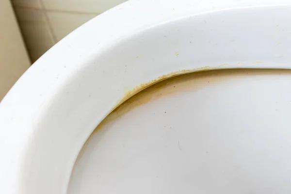 Dirty unhygienic toilet rim with limescale and rust stain at public restroom close up — Stock Photo, Image