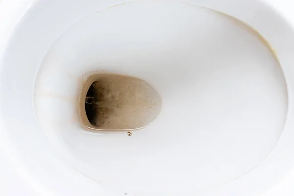 Dirty unhygienic toilet bowl with limescale stain at public restroom close up — Stock Photo, Image