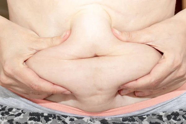 Mujer sosteniendo su vientre gordo, estómago con las manos, dieta, pérdida de peso y liposucción concepto —  Fotos de Stock
