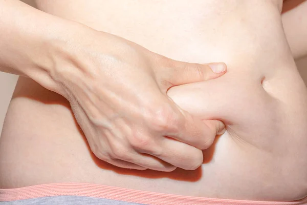 Mujer sosteniendo su vientre gordo, estómago con las manos, dieta, pérdida de peso y liposucción concepto —  Fotos de Stock