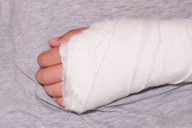 Alçı kutusunda bir çocuk kolu kırılmış, el yaralanması kaza sonucu, ön kol kemikleri kırılmış..