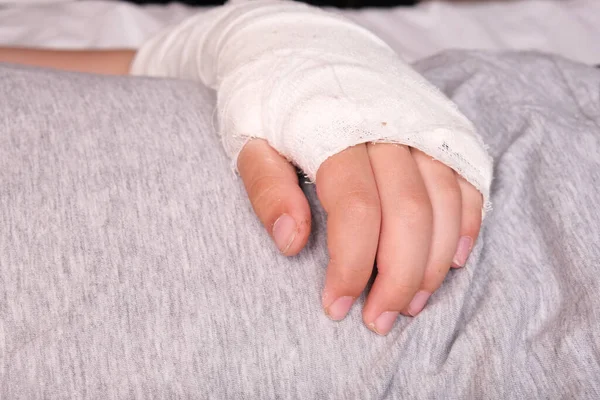 Ett Barn Bruten Arm Gips Fall Handskada Grund Olycka Underarmsben — Stockfoto