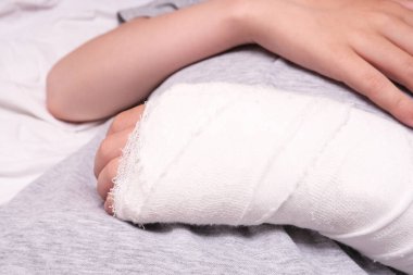 Alçı kutusunda bir çocuk kolu kırılmış, el yaralanması kaza sonucu, ön kol kemikleri kırılmış..