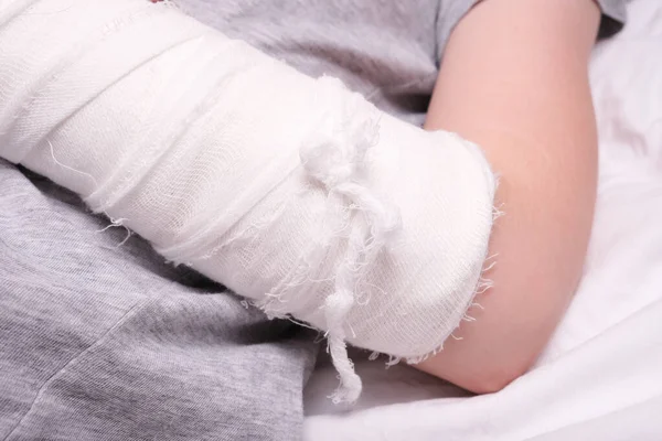 Alçı kutusunda bir çocuk kolu kırılmış, el yaralanması kaza sonucu, ön kol kemikleri kırılmış..