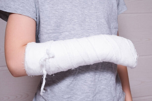 A child broken arm in plaster case, hand injury because of accident, forearm bones fracture.
