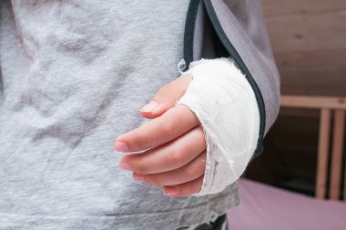 Alçı kutusunda kolu kırık bir çocuk ve tekstil bandajı, kazadan dolayı el yaralanması, ön kol kemiği kırığı..