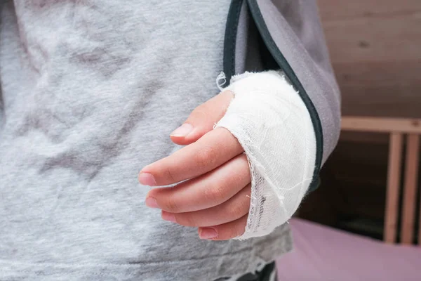 Alçı kutusunda kolu kırık bir çocuk ve tekstil bandajı, kazadan dolayı el yaralanması, ön kol kemiği kırığı..