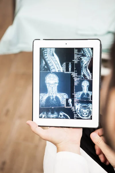 Medico leggendo il risultato della radiografia sul suo tablet pc — Foto Stock