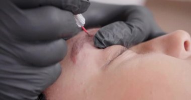 Portre dövme kaldırmak için iğne ile bir araç kullanarak