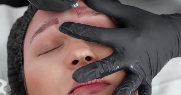 Plan rapproché d'un visage féminin pendant la procédure de retrait de tatouage — Video