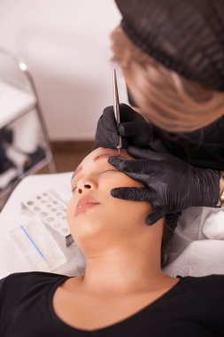 Dövme kaldırma için modern teknolojiyi kullanarak kadın güzellik uzmanı