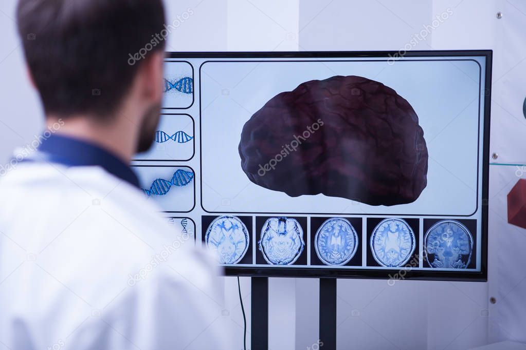 Young doctor checking a brain after nerve surgery