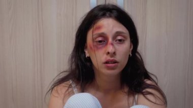 Gözü morarmış kadın acı çekiyor.