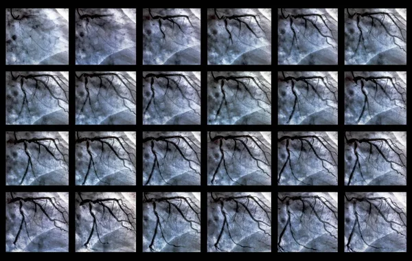 Cateterismo Ventriculografia Cardíaca Exame Imagem Médica Usado Para Determinar Função — Fotografia de Stock