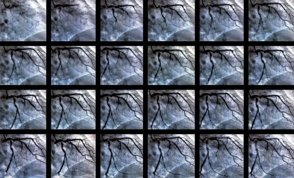 Cateterizzazione Ventricolografia Cardiaca Test Imaging Medico Utilizzato Determinare Funzione Cardiaca — Foto Stock