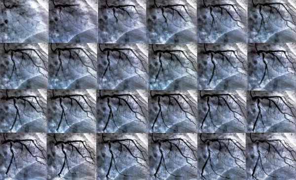 법입니다 Ventriculography은 오른쪽 실에서 환자의 기능을 테스트 — 스톡 사진