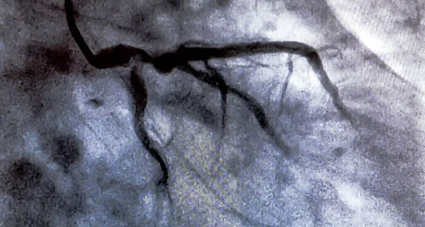 Cateterismo Ventriculografía Cardiaca Una Prueba Imagen Médica Utilizada Para Determinar —  Fotos de Stock