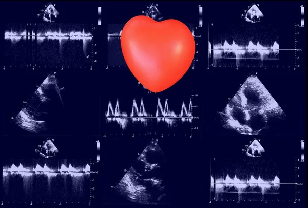 Cardiac ultrasound images and small heart . Screen of echo-cardiography machine. Doppler echo