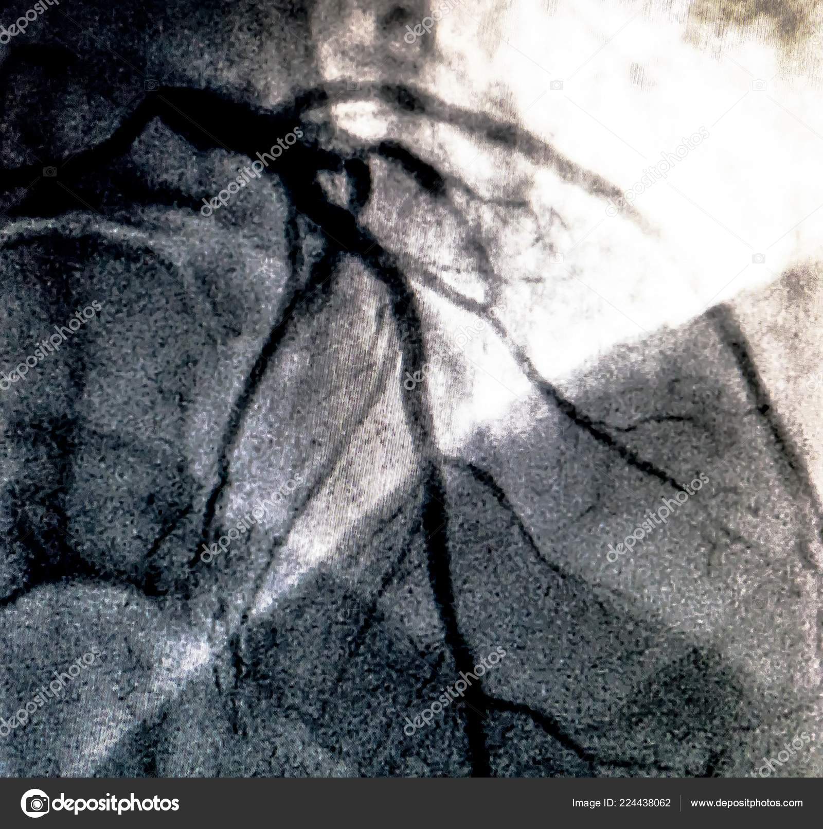 Catheterization Cardiac Ventriculography Medical Imaging Test Used