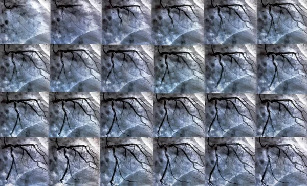 법입니다 Ventriculography 오른쪽 실에서 환자의 기능을 이미징 테스트입니다 콜라주 — 스톡 사진