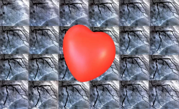 Catheterisatie Kleine Rood Hart Cardiale Ventriculography Een Medische Beeldvorming Test — Stockfoto