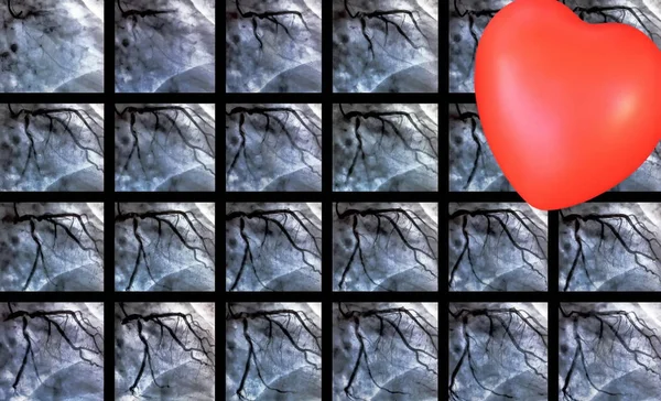 그리고 마음입니다 Ventriculography은 오른쪽 실에서 환자의 기능을 테스트 — 스톡 사진